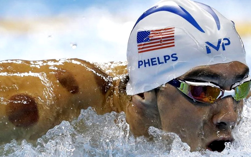 Experto en acupuntura explicó las marcas en la piel que luce Michael Phelps en los Juegos Olímpicos