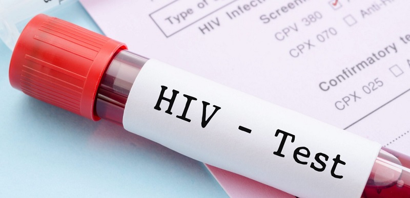 Jóvenes y comunidad ovallina podrán realizarse test rápido de VIH