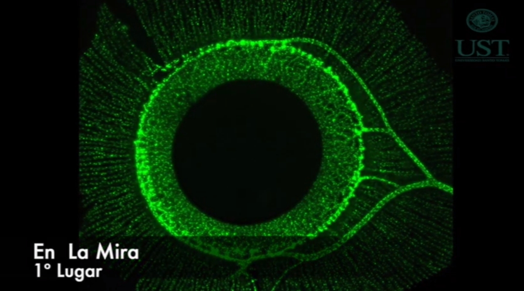 IV Concurso de Fotografía “Microscópica” de UST Valdivia tiene nuevos ganadores