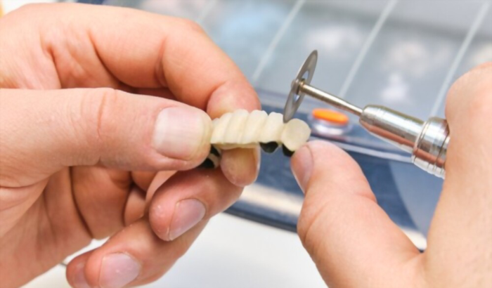 Técnico Laboratorista Dental: generador de autoestima y confianza